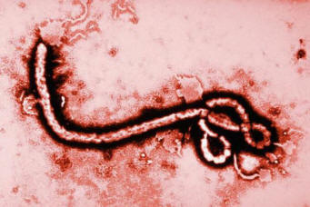 „Ebola