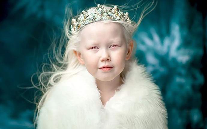 „Albinos